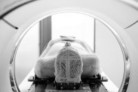 alzheimer-slmag042