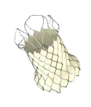 Prothèse valvulaire pulmonaire