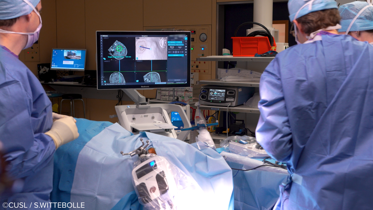 Neurochirurgie - opération d'épilepsie réfractaire