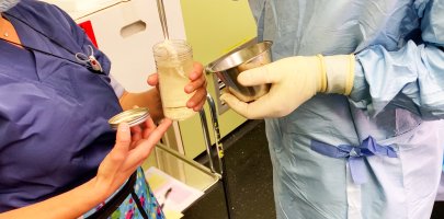Intervention chirurgicale pour une pseudarthrose congénitale du tibia
