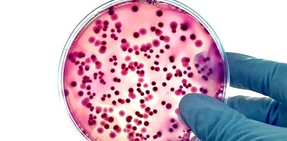 Colonies de bactéries